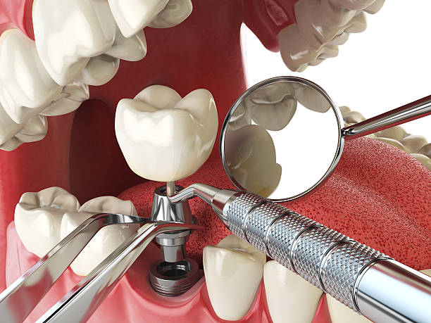 Best 24-Hour Emergency Dentist in Candler Mcafee, GA